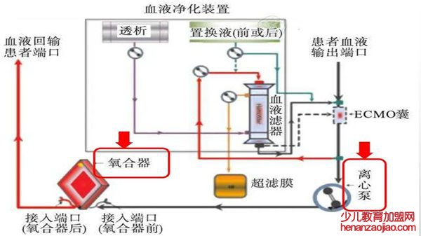 ECMO是什么意思,ecmo英语怎么读,ecmo为什么这么贵