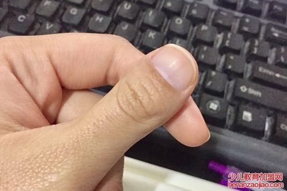 人的大拇指为什么只有两节,拇指怎么只有两个关节