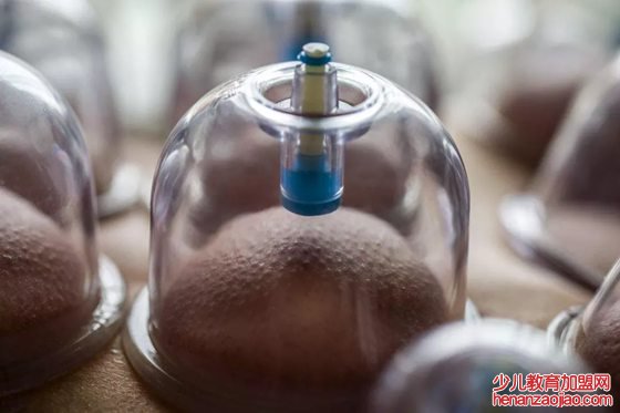 拔火罐为什么会起水泡,拔罐出水泡怎么办