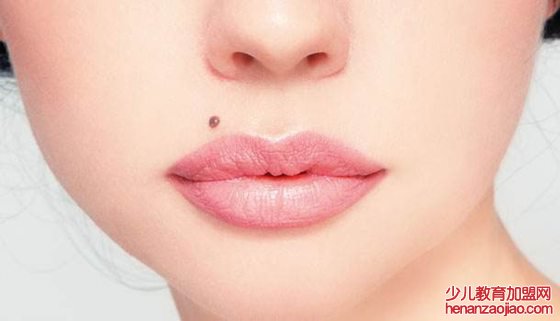 人为什么会长痣,痣越来越多怎么办