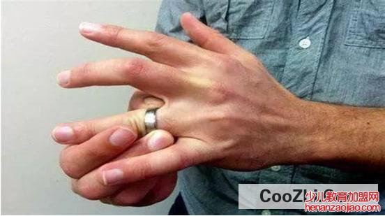 戒指卡手了怎么办