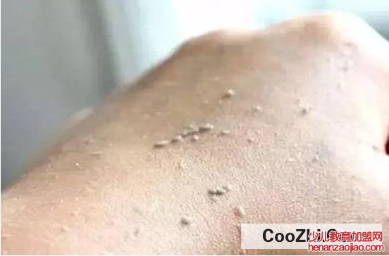 为什么天天洗澡，身体还是会搓出泥呢
