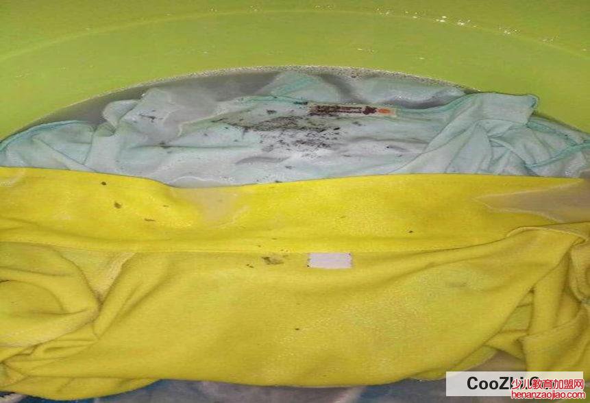 妙招巧除衣服上墨汁渍