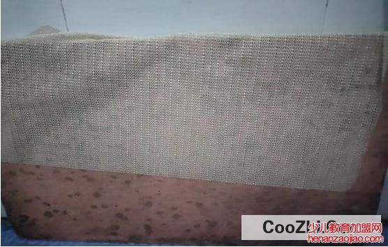 天天下雨房间有霉味怎么处理