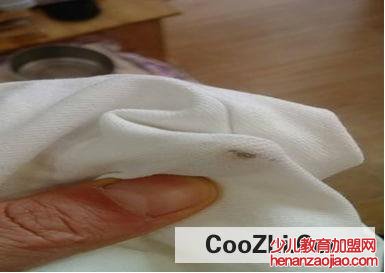 白裤子一块黄一块白处理措施