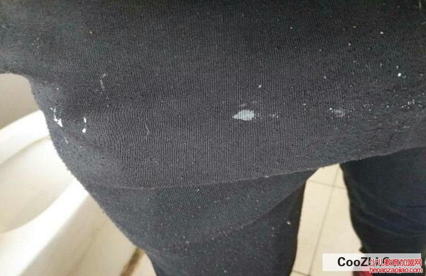 黑裤子上的白胶怎么样才能洗掉