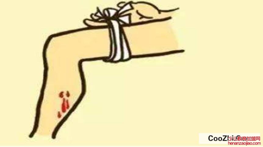 被蛇咬伤后如何紧急自救