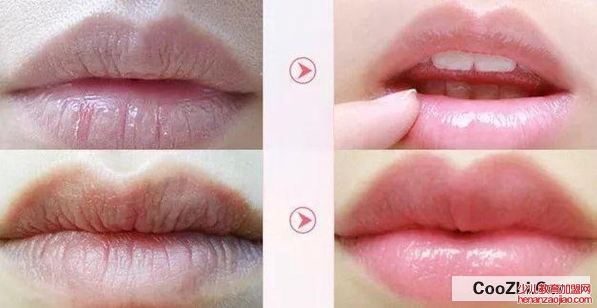 嘴唇上起皮怎么办？