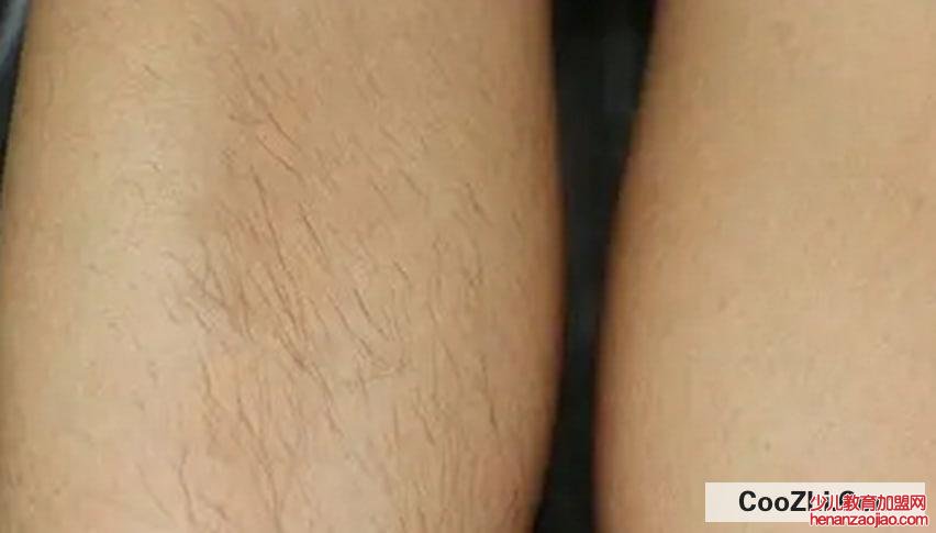 怎样可以使汗毛变淡