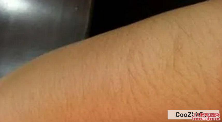 怎样可以使汗毛变淡