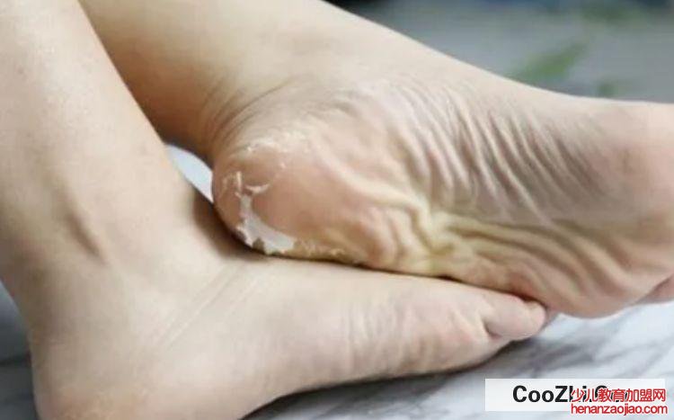 脚膜的正确用法