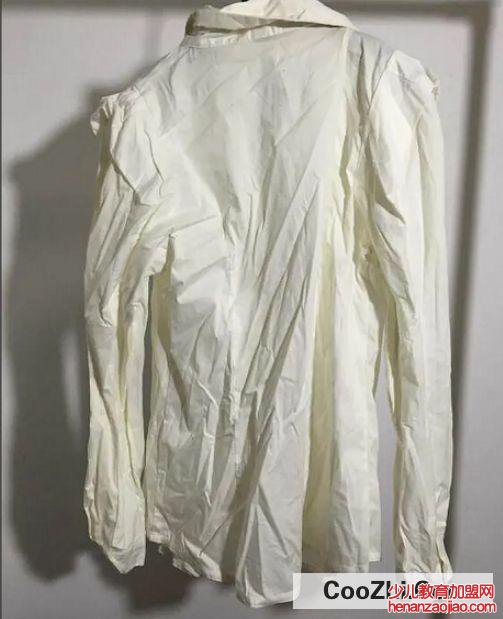 衣服烧黄了该怎么处理