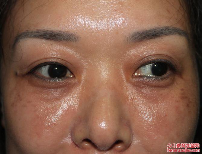 脸部肌肤黯淡无光该怎么办？