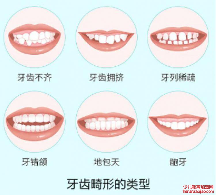 牙齿正畸需要注意什么内容？