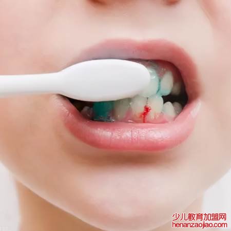 牙龈出血与缺乏哪种营养物质有关？