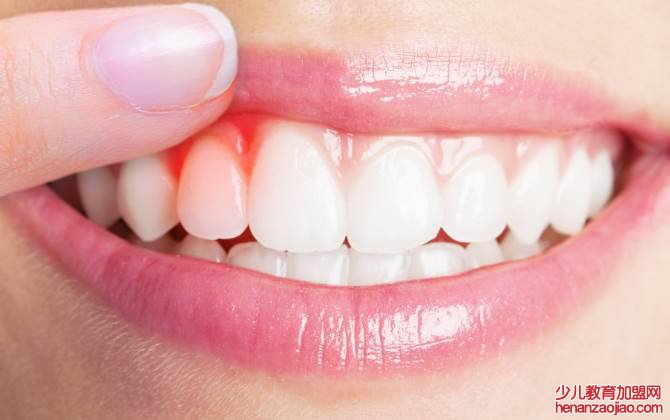 牙龈出血与缺乏哪种营养物质有关？