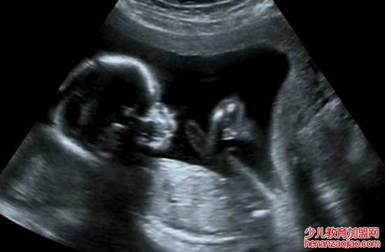 超声波在生活中还有什么用途呢？