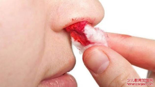 流鼻血的正确止血方法是什么？